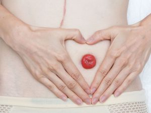 Atención al Paciente Ostomizado